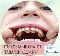 Как правильно приклеивать стразы на ногти - Мюсли. ру К чему снится красить ресницы?