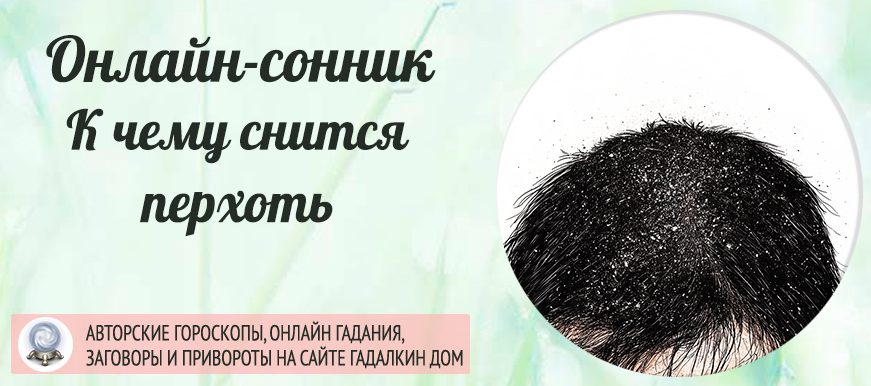 Перхоть сонник