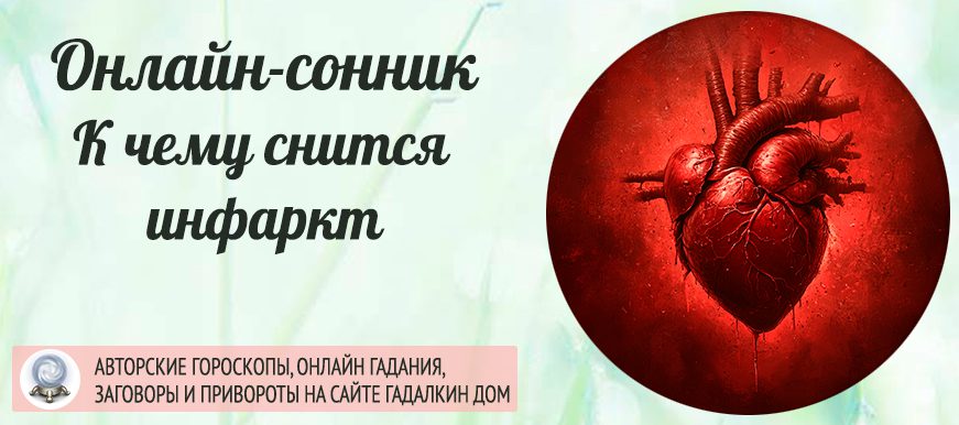 Вам приснилось, что у вас инфаркт