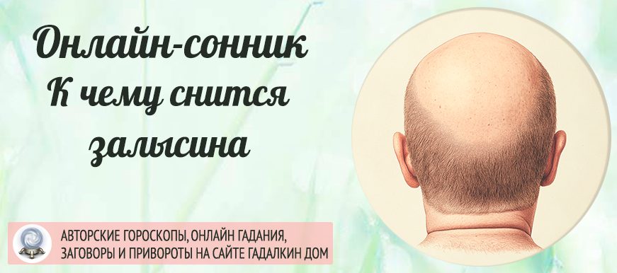 Залысина во сне