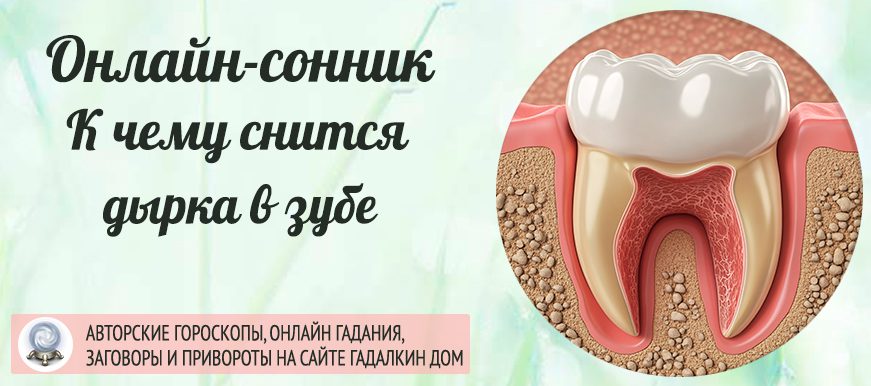 Сонник: дырка в зубе