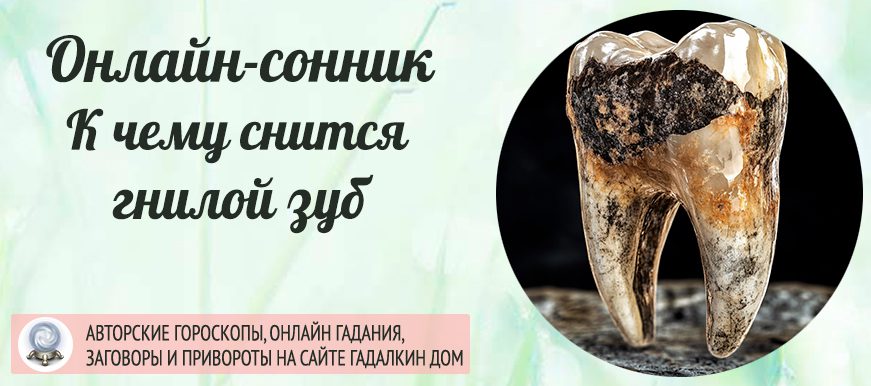 Сонник: гнилой зуб