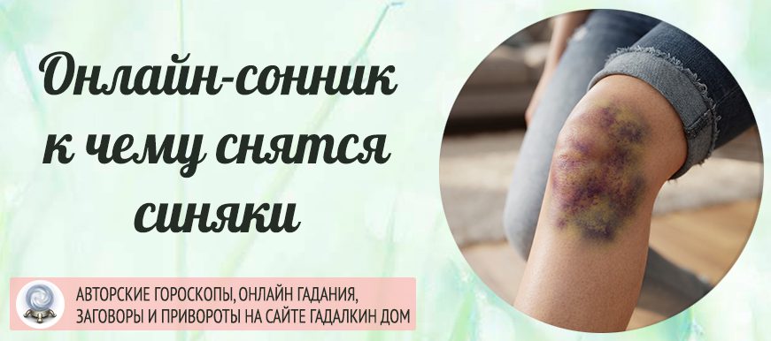 сонник синяк